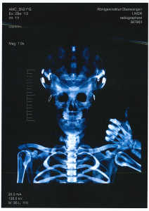 fiktiven Röntgenbildern